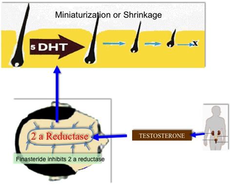 finasteride mechanism of action hair